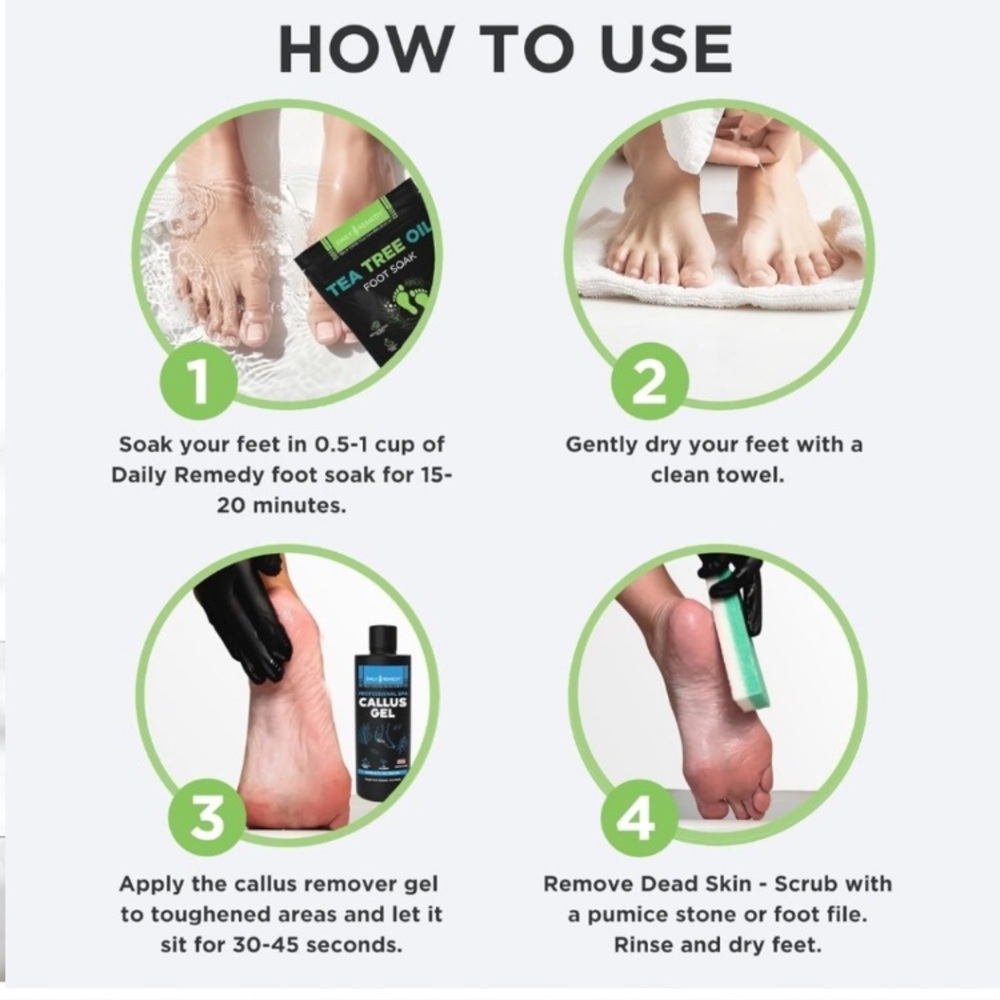 Foot Callus Remover Gel Set - Picture 4 of 5
